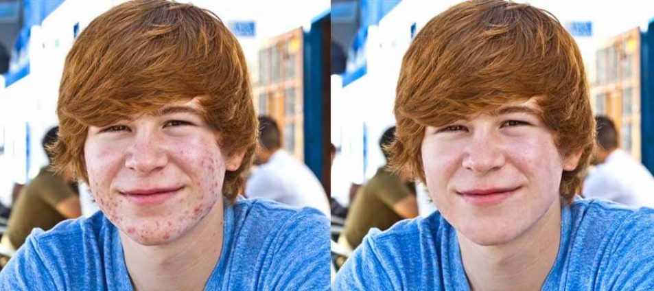 Photoshop Retouching service, hing end retouching images | We have been providing all kind of beauty retouching services since 12 years. | Clipping Path Source Photoshop Retouching service, hing end retouching images | We have been providing all kind of beauty retouching services since 12 years. | Clipping Path Source